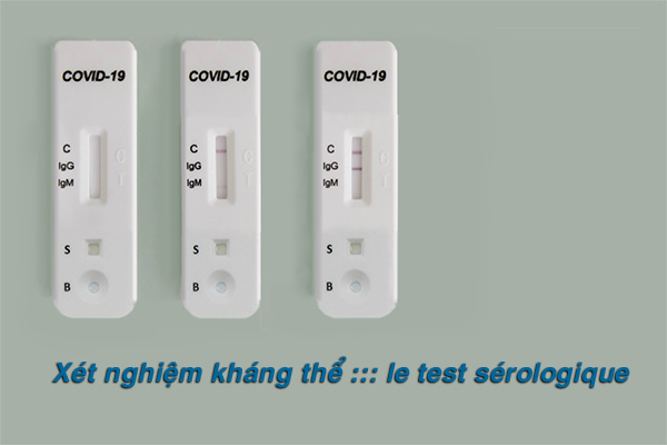 COVID-19 : xét nghiệm huyết thanh ::: test sérologique